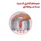 خردکن مولینکس مدل DPA144
